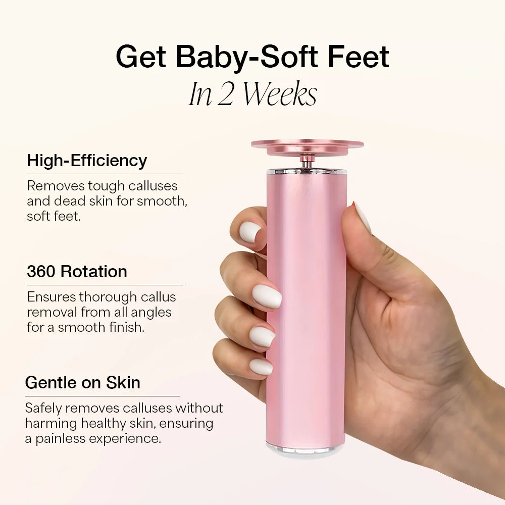 SoftFeet 2.0